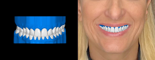 DSD PROVIDER DENTAL COURSE Need a simplified approach to treatment planning